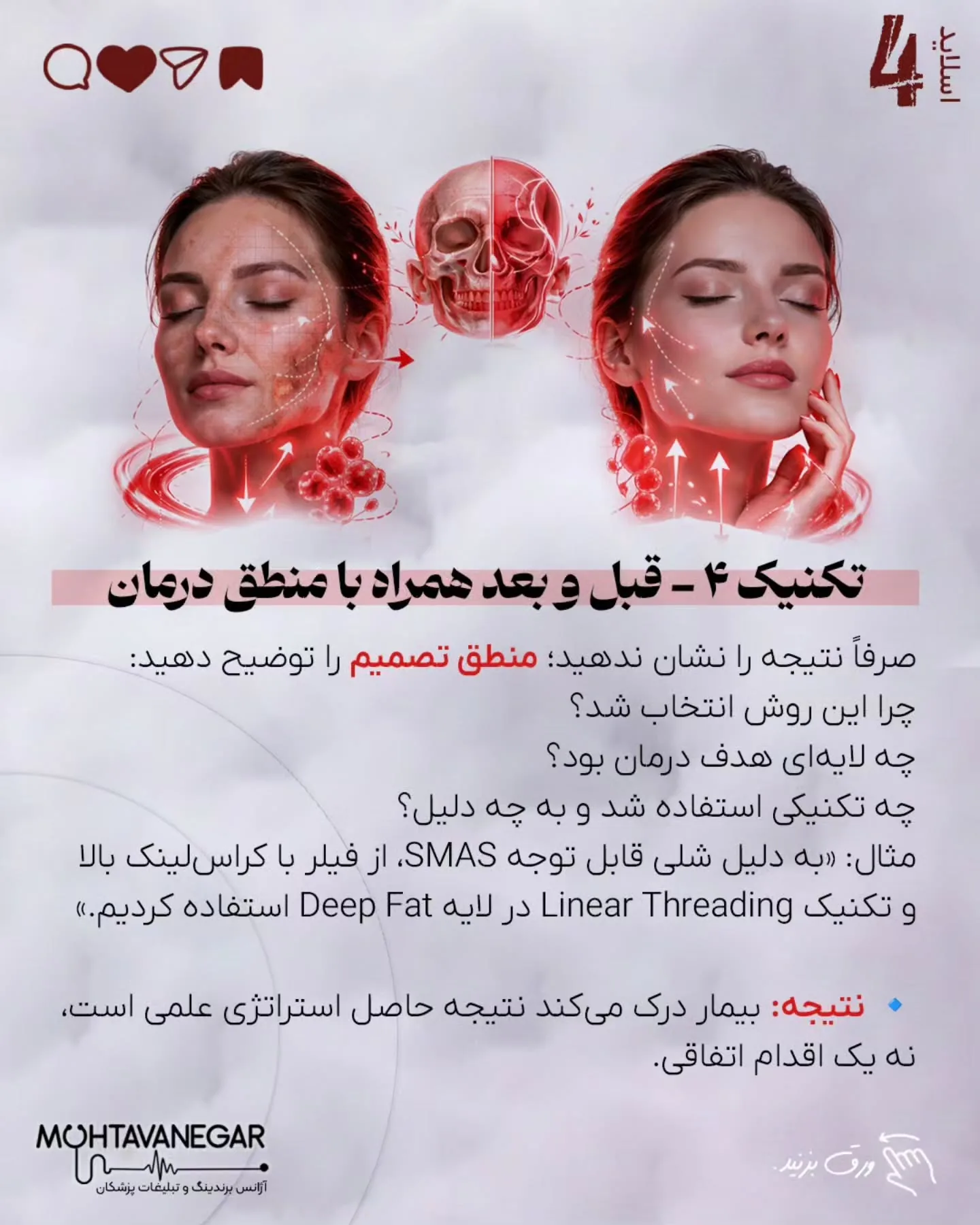 اسلایدها را ورق بزنید تا با ۷ تکنیک علمی برندینگ پزشکی آشنا شوید و بدانید چطور اعتبار علمی خود را به…؛ اسلاید 5 از 10