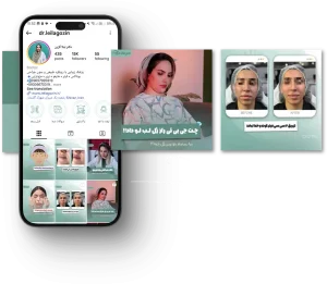 تولید محتوای اینستاگرام